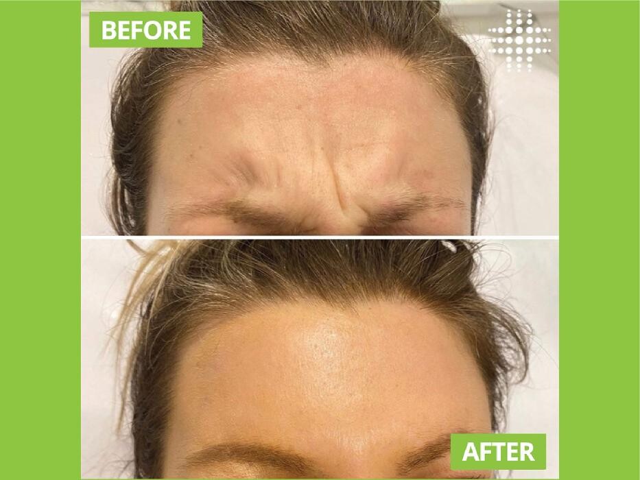 Images Results Laser Clinic Blacktown