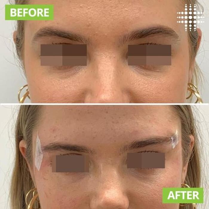 Images Results Laser Clinic Blacktown