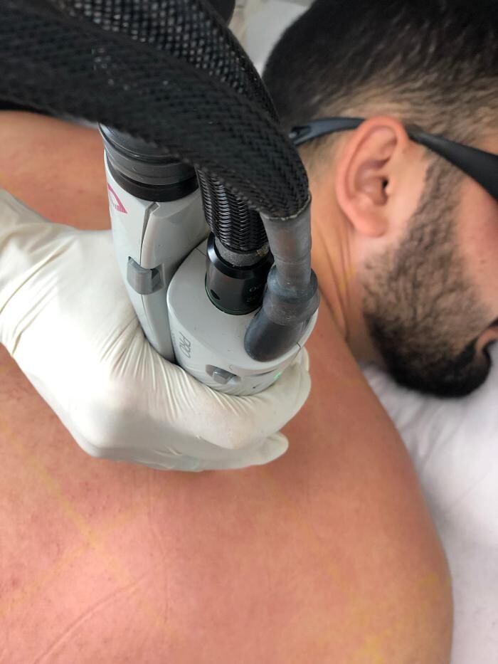 Images Results Laser Clinic Blacktown