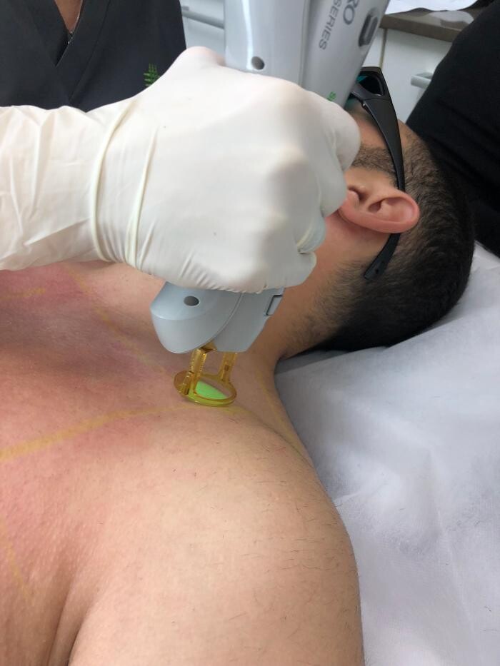 Images Results Laser Clinic Blacktown