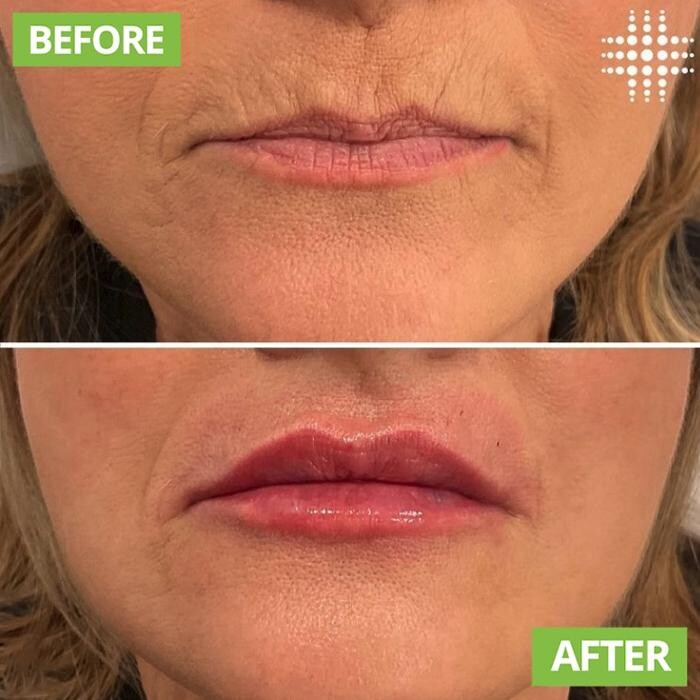 Images Results Laser Clinic Blacktown