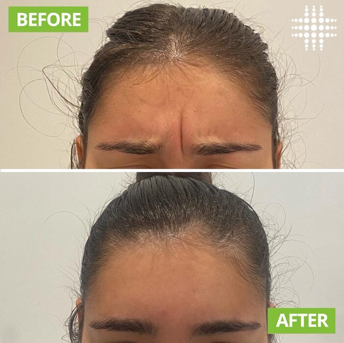 Images Results Laser Clinic Blacktown
