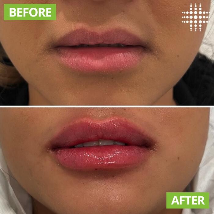 Images Results Laser Clinic Blacktown