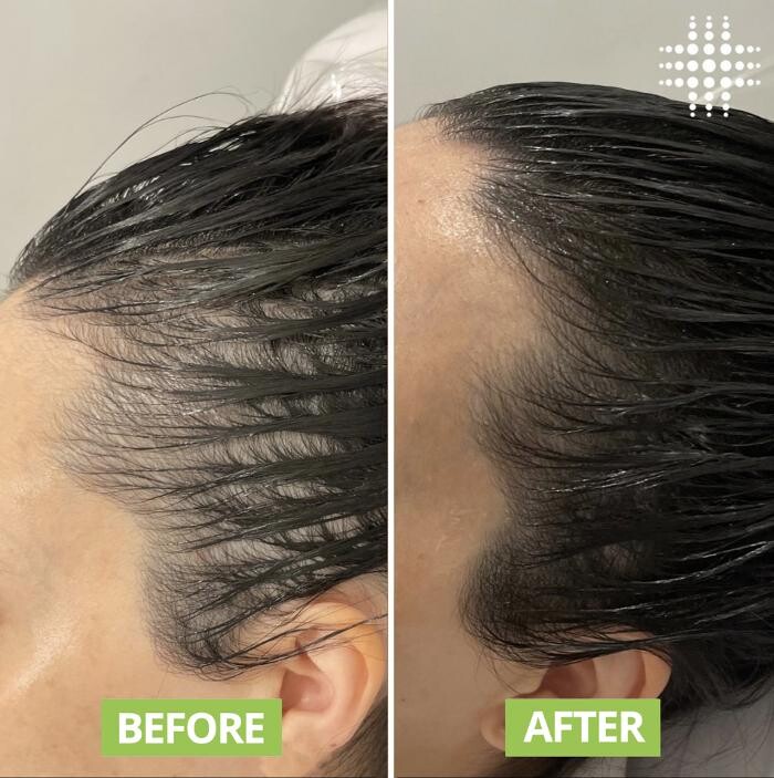 Images Results Laser Clinic Blacktown