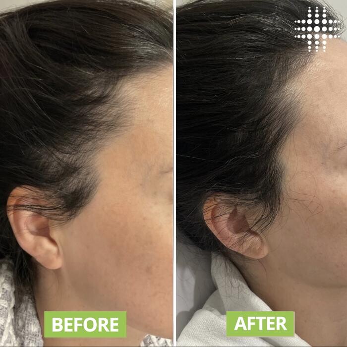 Images Results Laser Clinic Blacktown