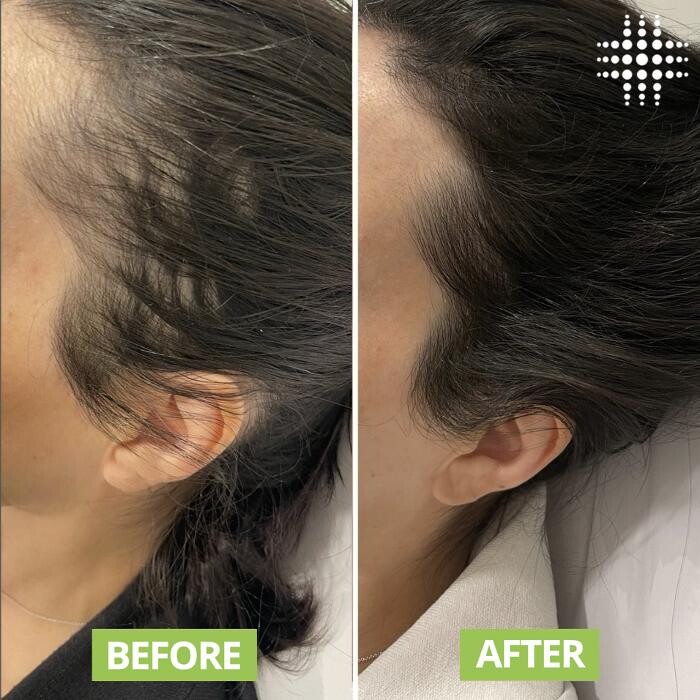 Images Results Laser Clinic Blacktown
