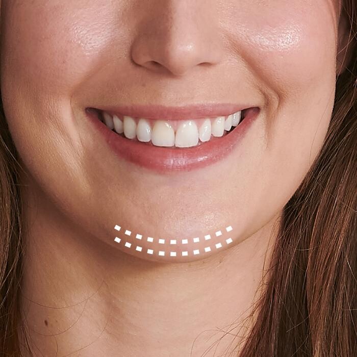 Images Results Laser Clinic Blacktown