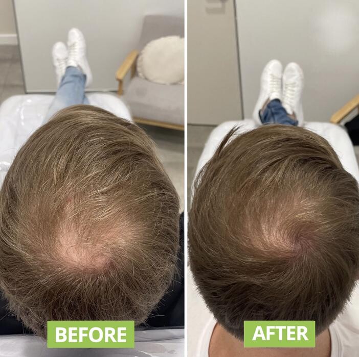 Images Results Laser Clinic Blacktown