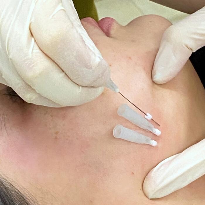 Images Results Laser Clinic Blacktown
