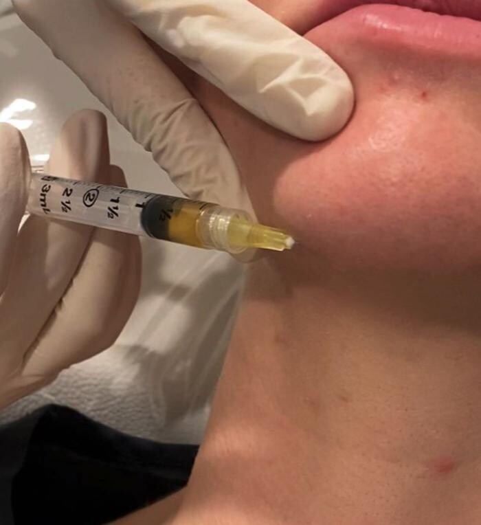 Images Results Laser Clinic Blacktown