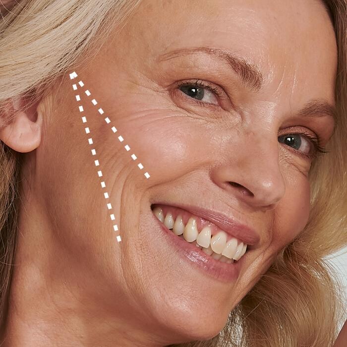 Images Results Laser Clinic Blacktown