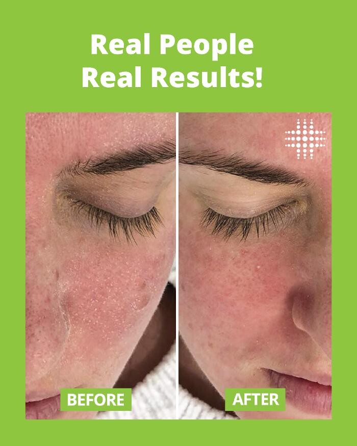 Images Results Laser Clinic Blacktown