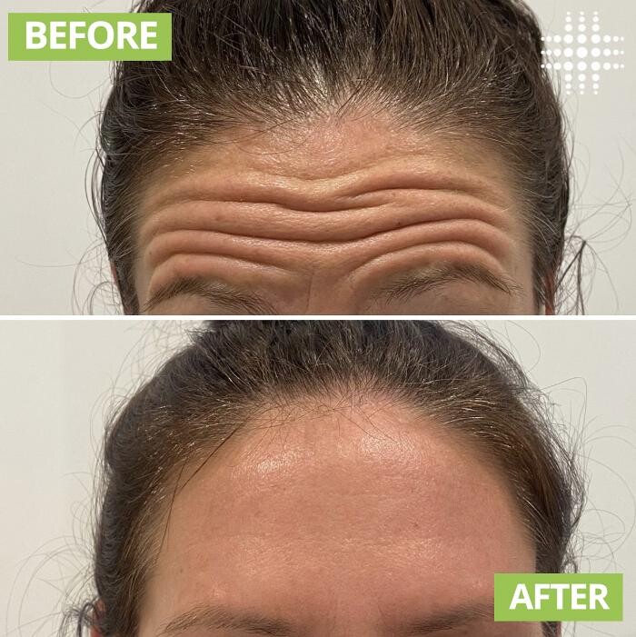 Images Results Laser Clinic Blacktown