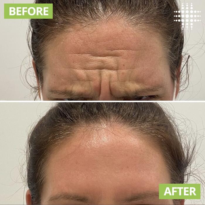 Images Results Laser Clinic Blacktown