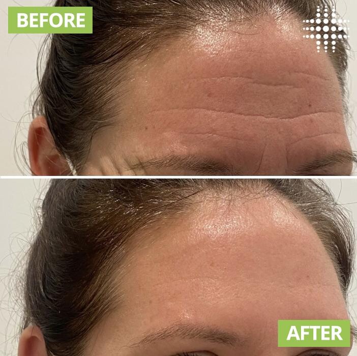 Images Results Laser Clinic Blacktown