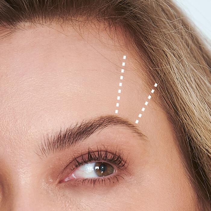 Images Results Laser Clinic Blacktown