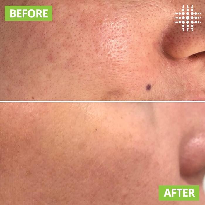 Images Results Laser Clinic Blacktown