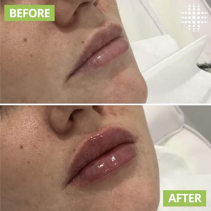 Images Results Laser Clinic Blacktown