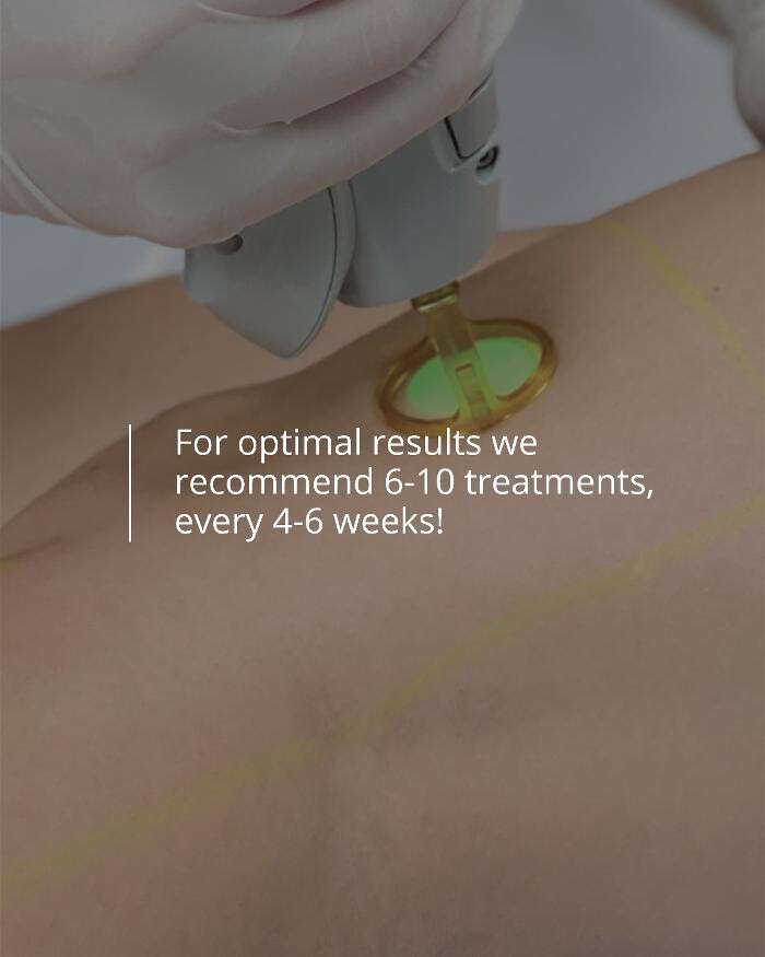 Images Results Laser Clinic Blacktown