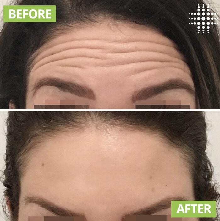 Images Results Laser Clinic Blacktown
