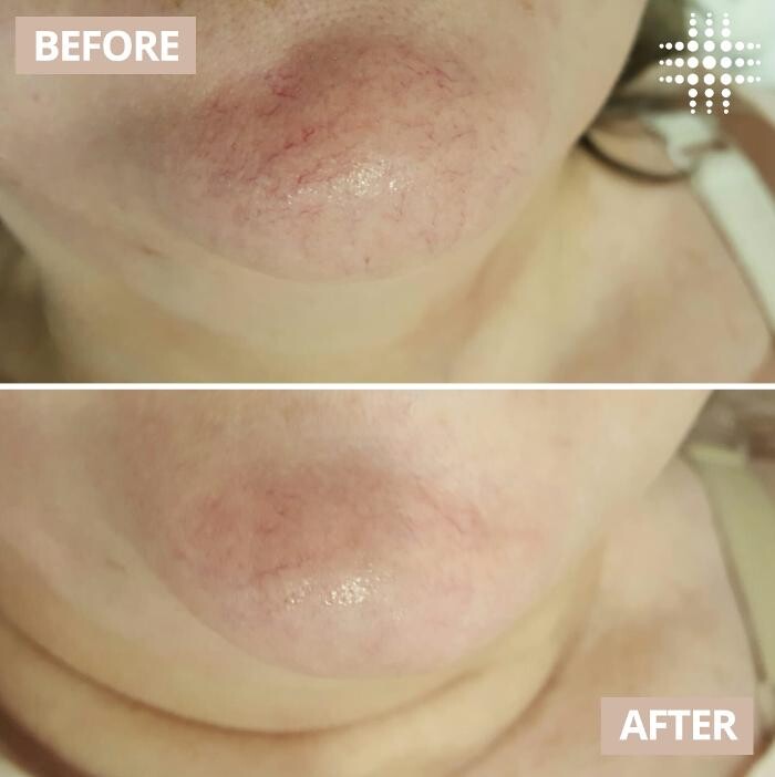 Images Results Laser Clinic Blacktown