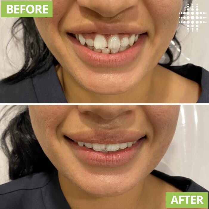 Images Results Laser Clinic Blacktown