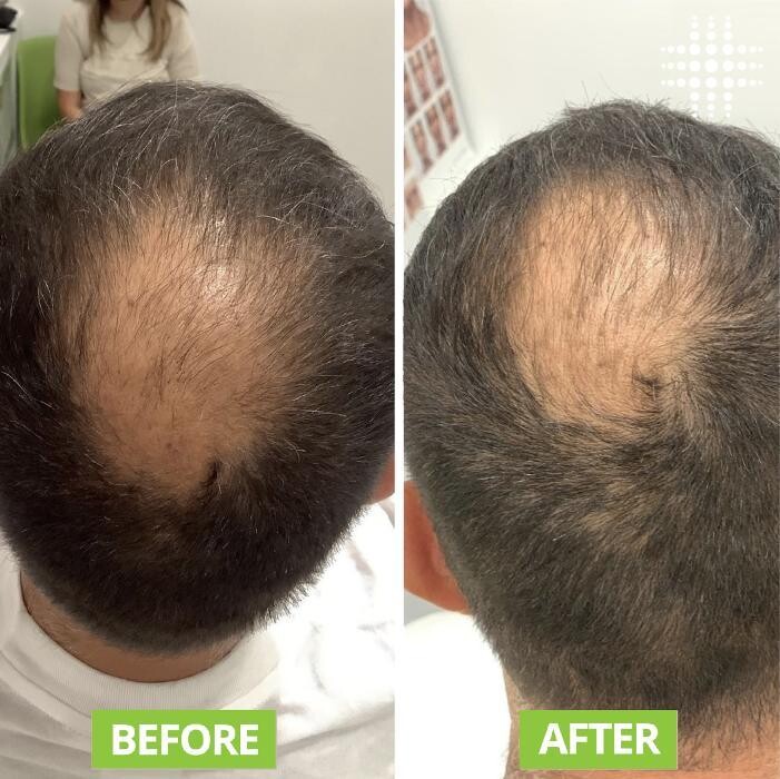 Images Results Laser Clinic Blacktown