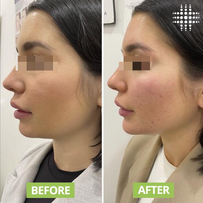 Images Results Laser Clinic Blacktown