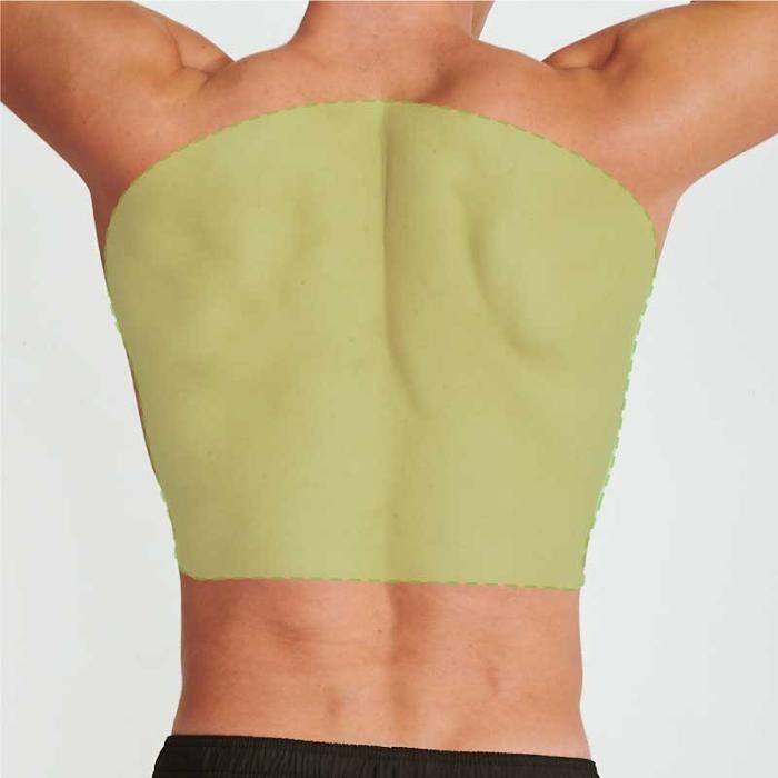 Images Results Laser Clinic Blacktown