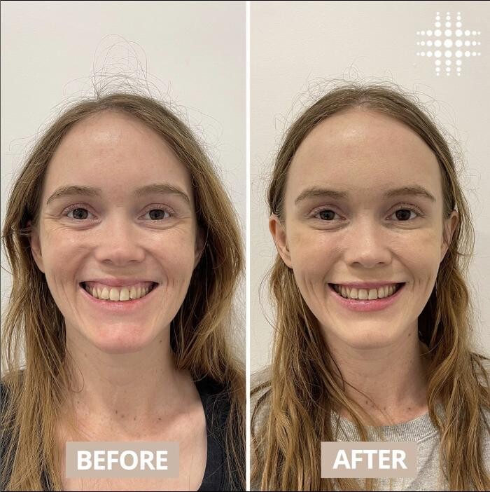 Images Results Laser Clinic Blacktown