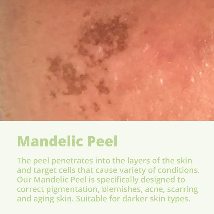 Images Results Laser Clinic Blacktown
