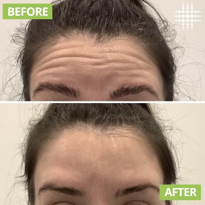 Images Results Laser Clinic Blacktown