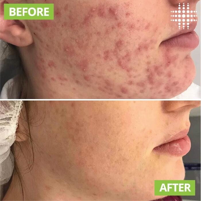 Images Results Laser Clinic Blacktown