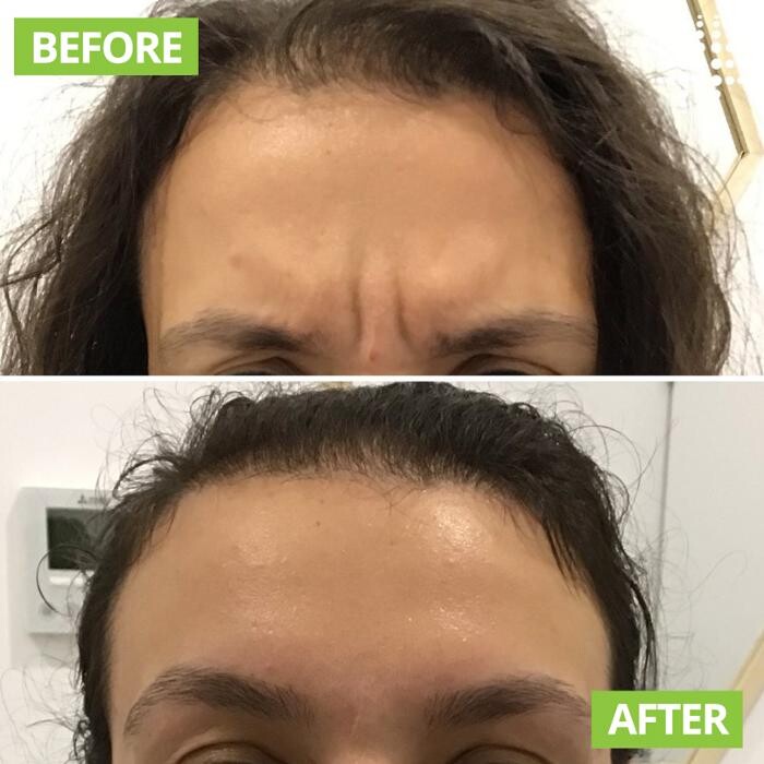 Images Results Laser Clinic Blacktown