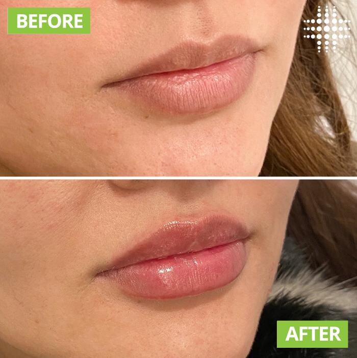 Images Results Laser Clinic Blacktown