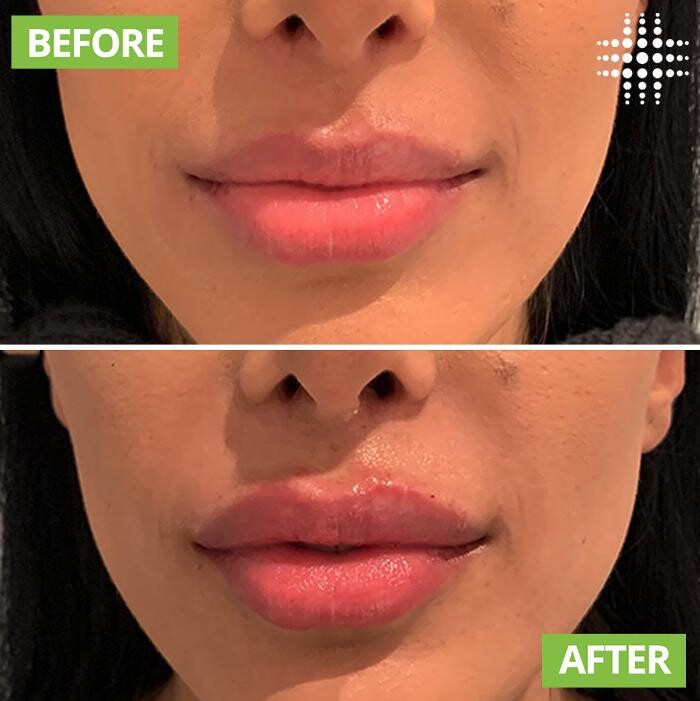 Images Results Laser Clinic Blacktown