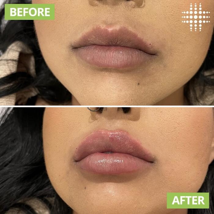 Images Results Laser Clinic Blacktown