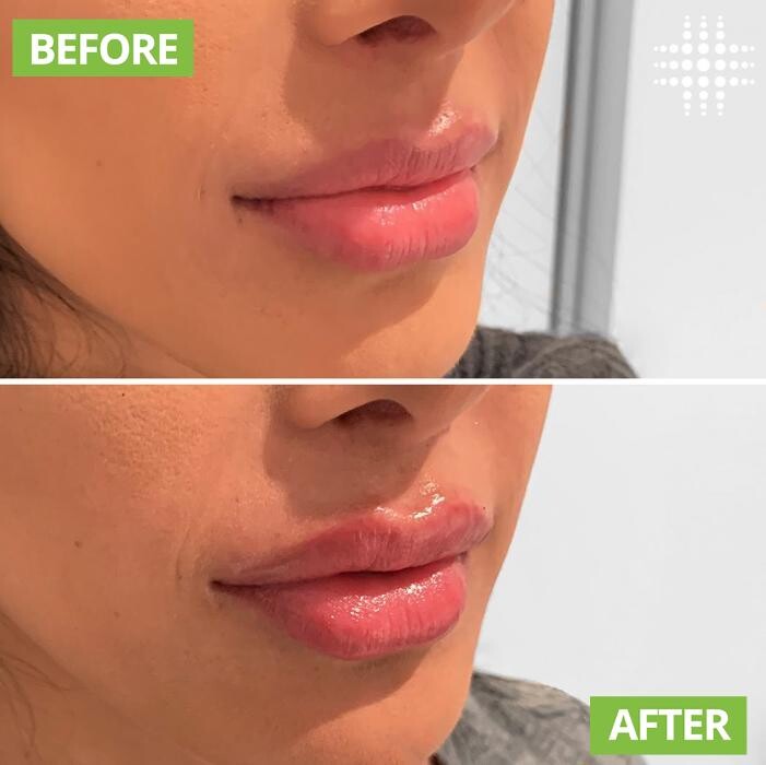 Images Results Laser Clinic Blacktown