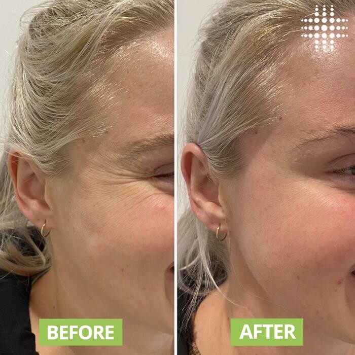 Images Results Laser Clinic Blacktown