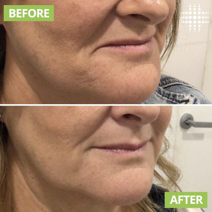 Images Results Laser Clinic Blacktown