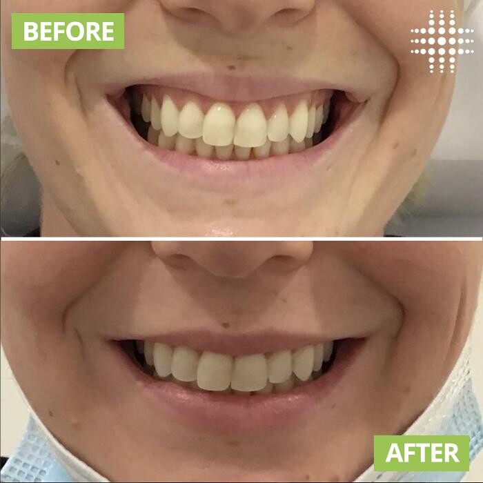 Images Results Laser Clinic Blacktown