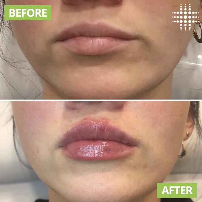 Images Results Laser Clinic Blacktown