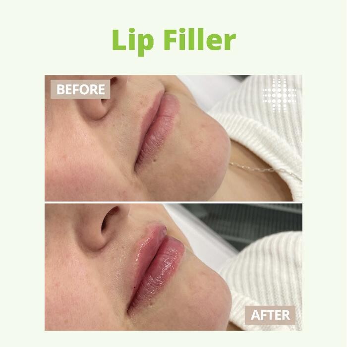 Images Results Laser Clinic Blacktown
