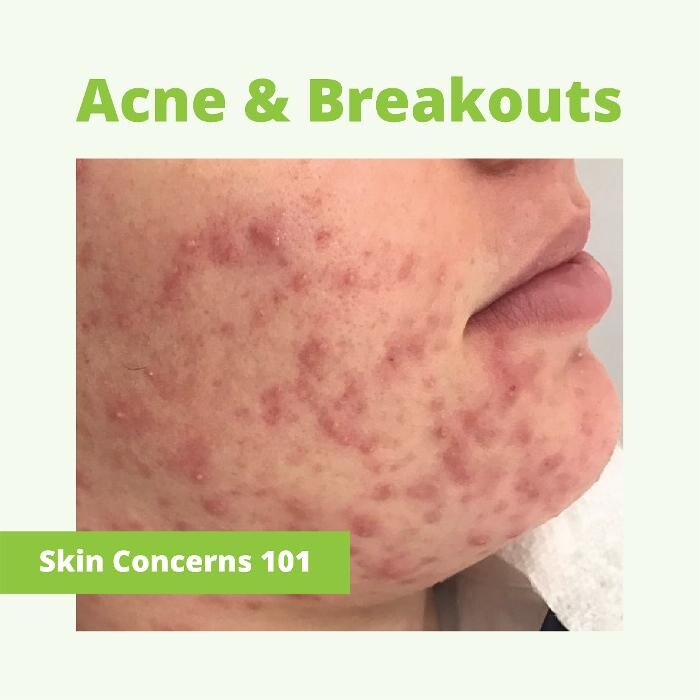 Images Results Laser Clinic Blacktown