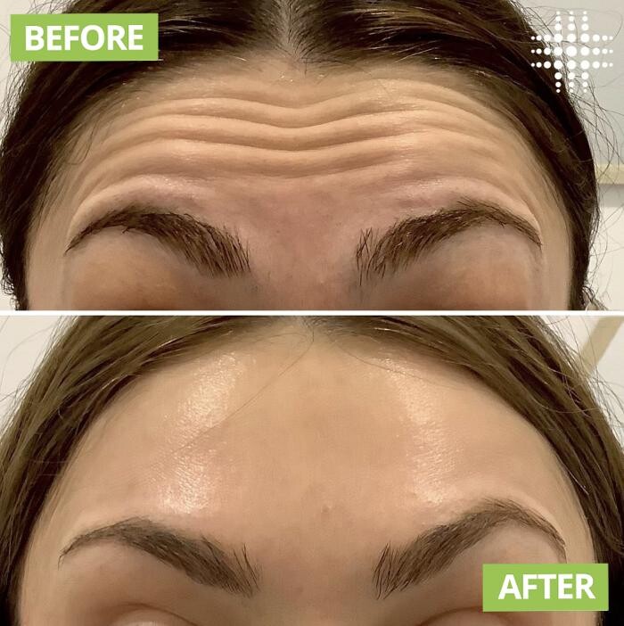 Images Results Laser Clinic Blacktown