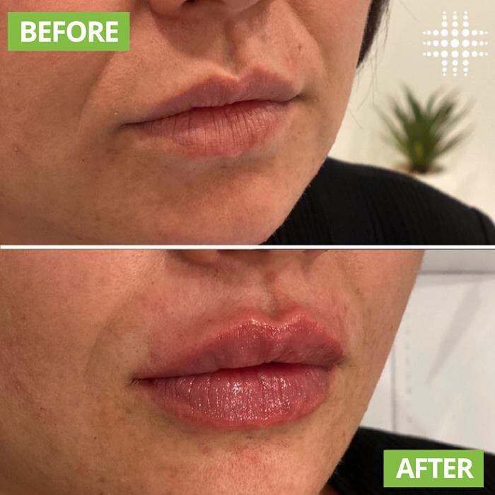 Images Results Laser Clinic Blacktown