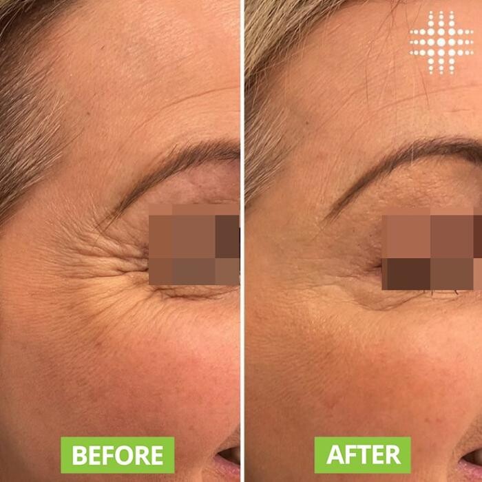 Images Results Laser Clinic Blacktown