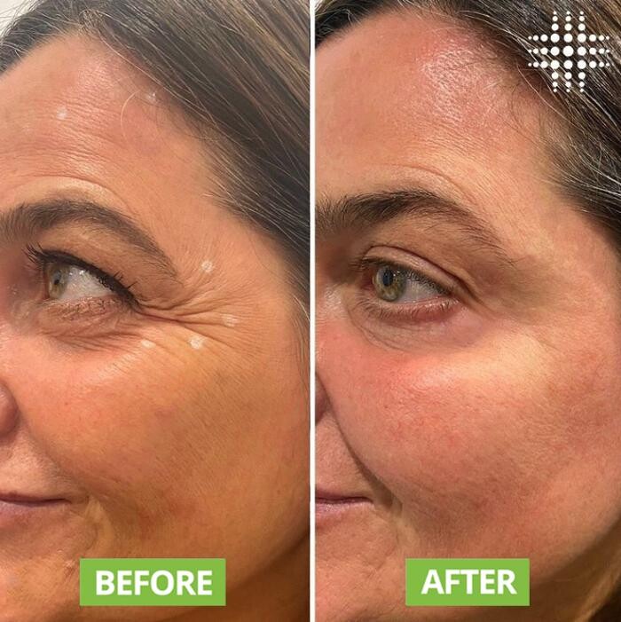 Images Results Laser Clinic Blacktown