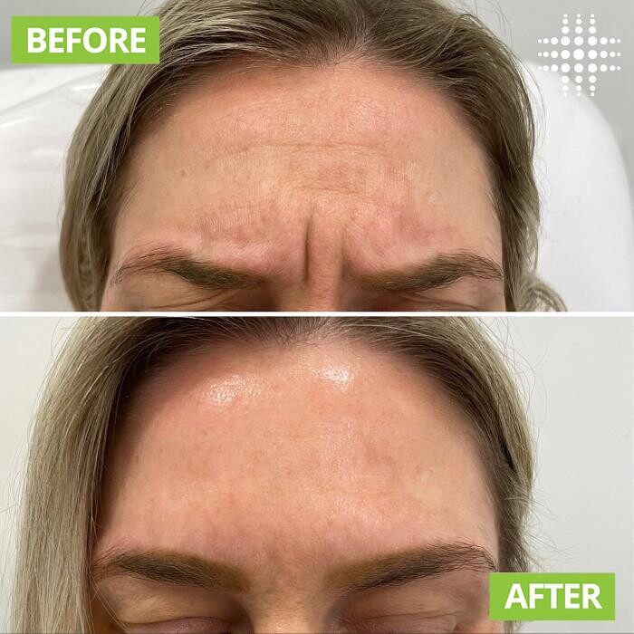 Images Results Laser Clinic Blacktown