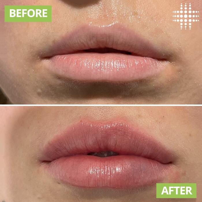 Images Results Laser Clinic Blacktown